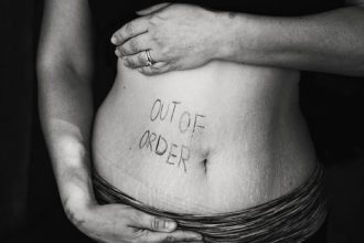 BARRIGA INCHADA-saude-cura-superacao-carvao_ativado
