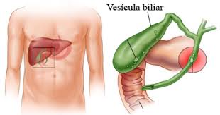 vesicula_biliar-saude -cura -